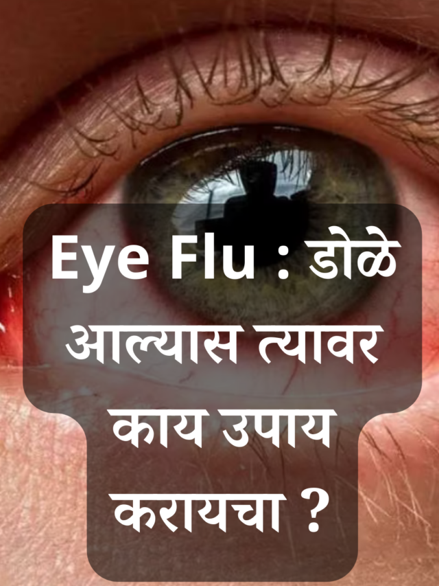 Eye Flu : डोळे आल्यास त्यावर काय उपाय करायचा ?